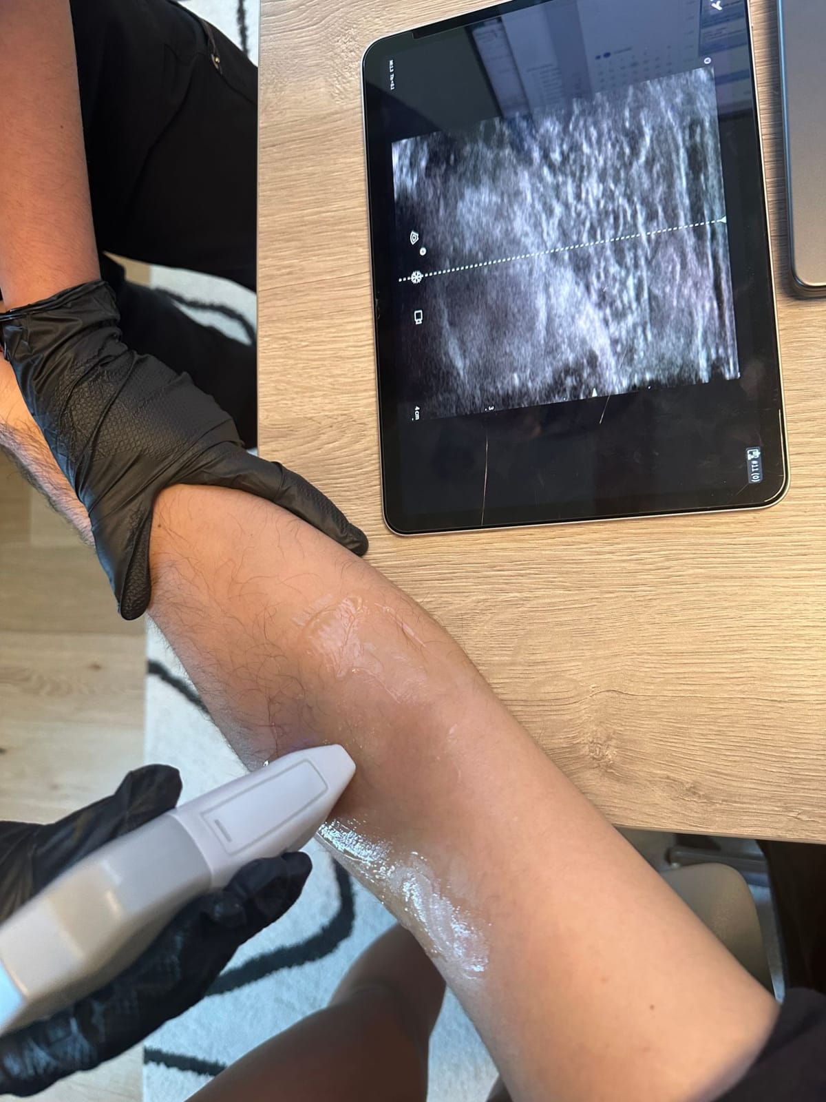 Live ultrasound vein image on a tablet during an IV visit