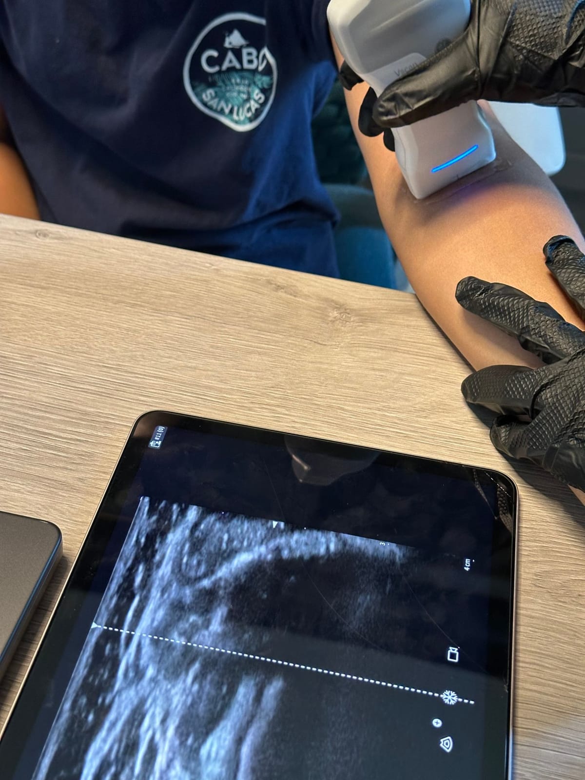 Nurse Practitioner locating a vein on a client's upper arm with a handheld ultrasound